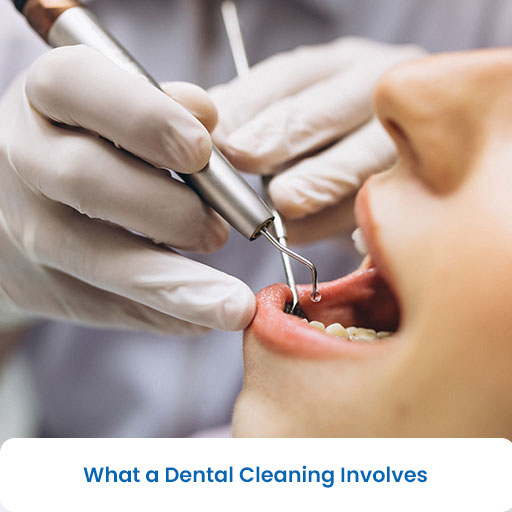 What a Dental Cleaning Involves