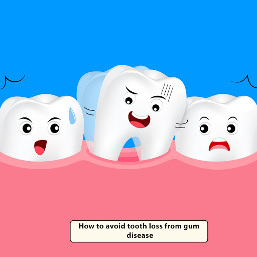 How To Avoid Tooth Loss From Gum Disease