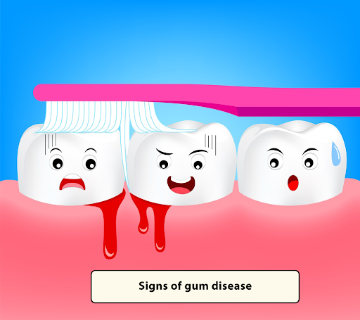 Signs Of Gum Disease