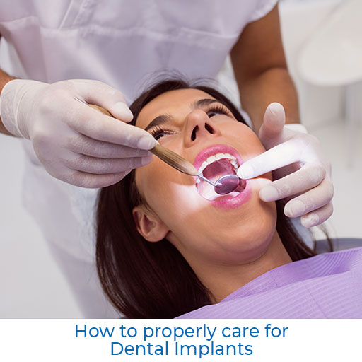 How to properly care for Dental Implants