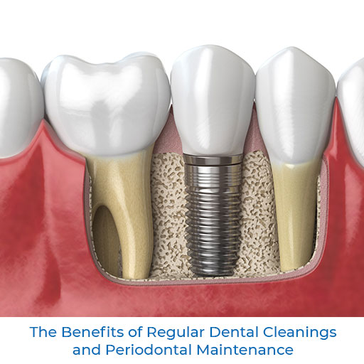 The Benefits of Regular Dental Cleanings and Periodontal Maintenance