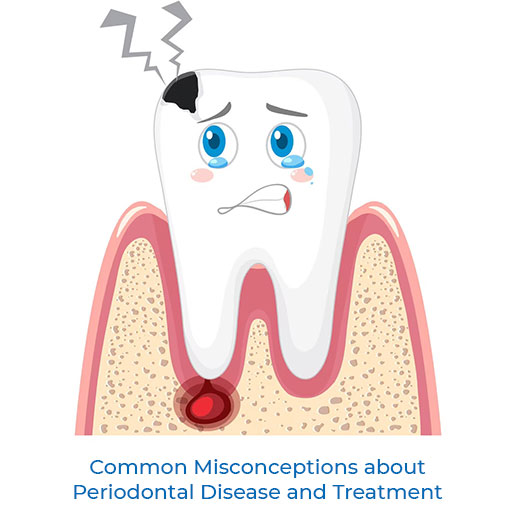 Common Misconceptions about Periodontal Disease and Treatment