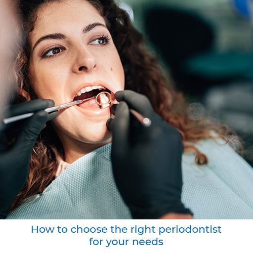 How to choose the right periodontist for your needs