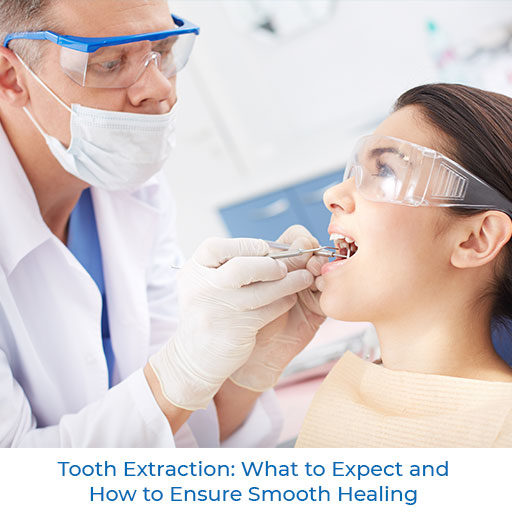 Tooth Extraction: What to Expect and How to Ensure Smooth Healing