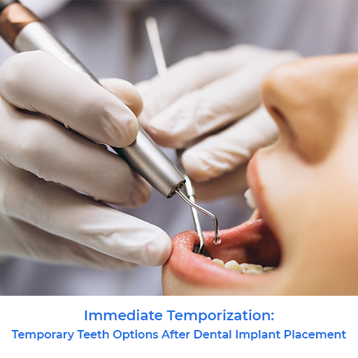 Immediate Temporization: Temporary Teeth Options After Dental Implant Placement