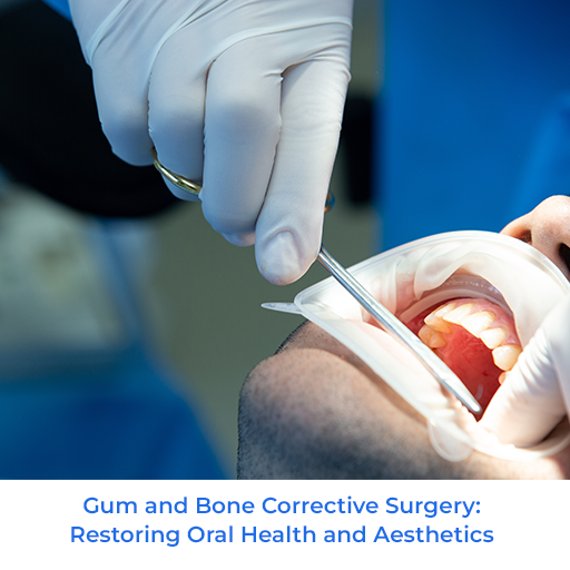 Gum and Bone Corrective Surgery: Restoring Oral Health and Aesthetics