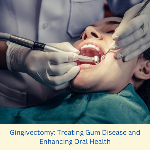 Gingivectomy: Treating Gum Disease and Enhancing Oral Health