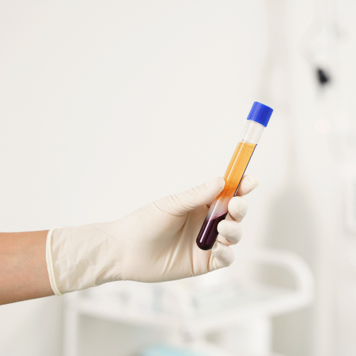  Platelet-Rich Plasma (PRP) Therapy: Harnessing the Power of Growth Factors
