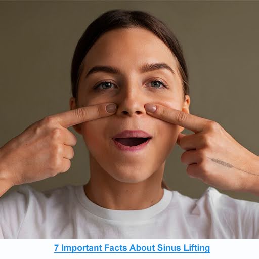 7 Important Facts About Sinus Lifting