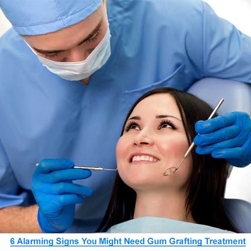 6 Alarming Signs You Might Need Gum Grafting Treatment