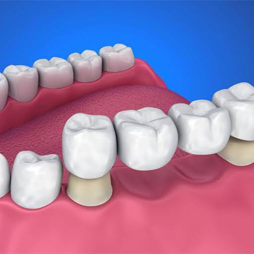 Prevention of Bone Resorption