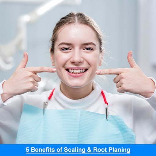 5 Benefits of Scaling & Root Planing