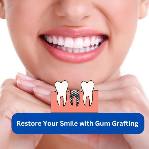 Restore-Your-Smile-with-Gum-Grafting