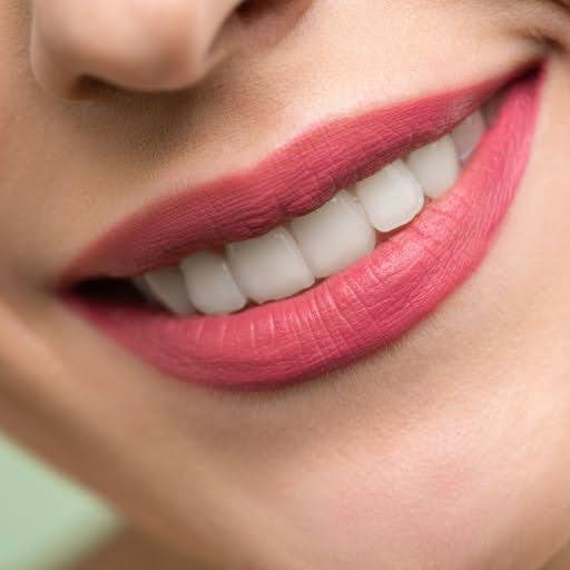 Restore-Your-Smile-with-Gum-Grafting-8