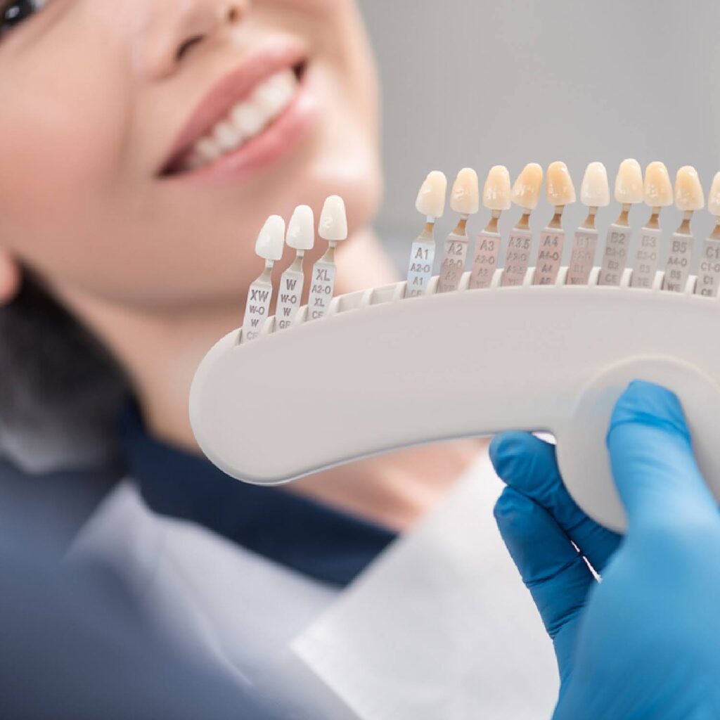 Tips-on-Choosing-a-Cosmetic-Dentist-in-Bucks-County-PA-2