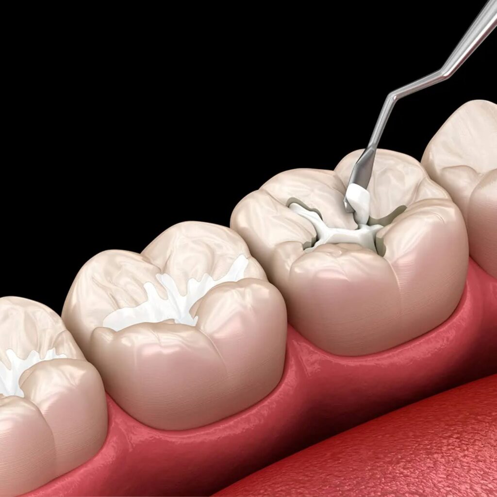 No More Cavities Smart Daily Habits for Stronger Teeth 7