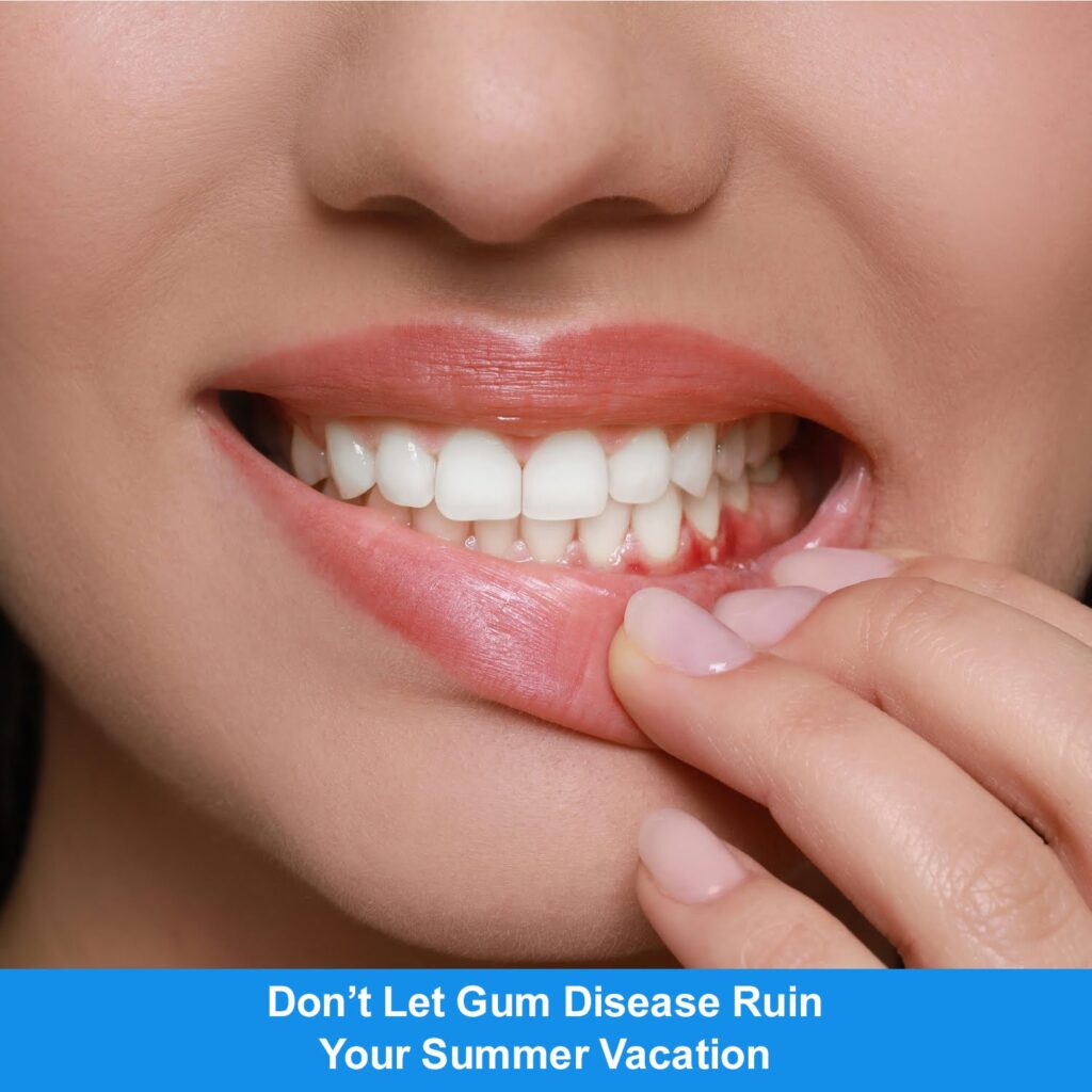 Don’t Let Gum Disease Ruin Your Summer Vacation