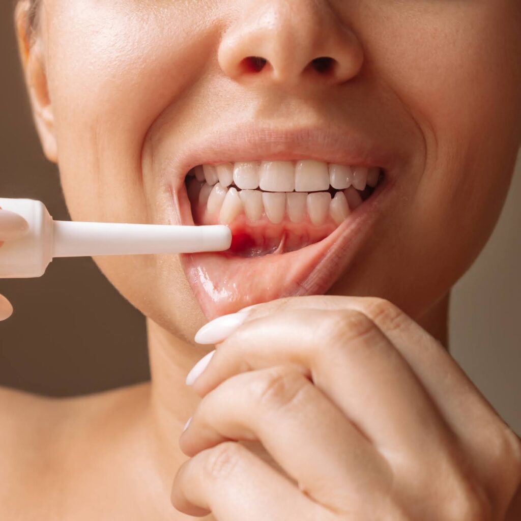 Don’t Let Gum Disease Ruin Your Summer Vacation 2